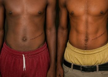 Abuja Kidney Trade Scandal: Suspect Allegedly Reveals ₦7m Kidney Deal, Names Hospital