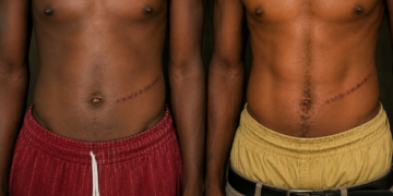 Abuja Kidney Trade Scandal: Suspect Allegedly Reveals ₦7m Kidney Deal, Names Hospital